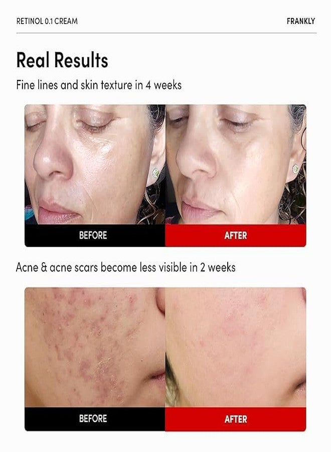 FRANKLY Retinol 0.1% Cream, 1.01 fl oz - Beginner Retinol | Night Cream | with Ceramides & Natural Ginseng | Anti-aging, Wrinkles Care, Reduces Congestion and hyperpigmentation | Korean Skin Care - Image 2